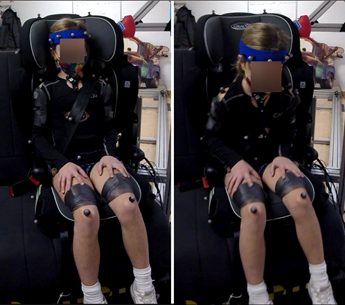 pre-pretensioner study image